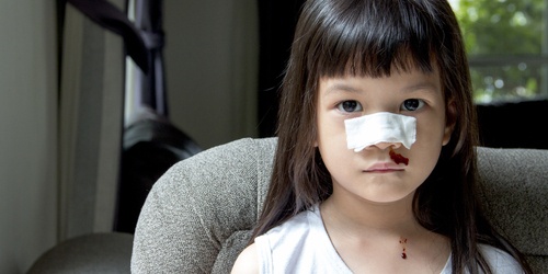 10 Cara Menaikkan Trombosit pada Anak