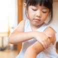 Penyebab Gatal Alergi pada Anak dan Cara Menanganinya