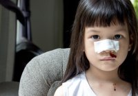 10 Cara Menaikkan Trombosit pada Anak